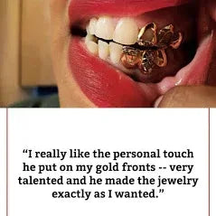 2 Gold Teeth: 10k Sunshine Cutz W/Back Bridge image 1