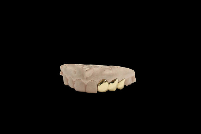 3 Gold Teeth: 14K 3 Piece Plain Solid Perm Cuts image 0