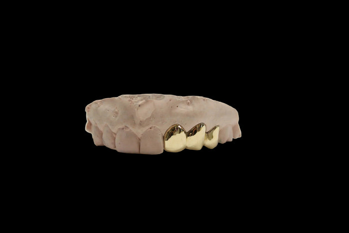 3 Gold Teeth: 14K 3 Piece Plain Solid Perm Cuts image 1