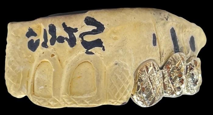 3 Gold Teeth: 10k gold image 1