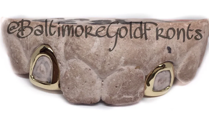 10K Gold 2 Open Face Gold Crown w/ Back Bridge image 0