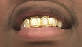 10K Gold 4 Open-Face with Diamond Cutz Around image 0