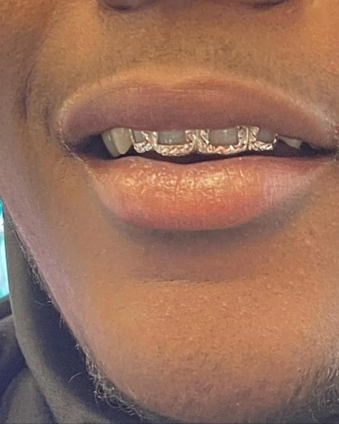 4 Silver Teeth: Open Face With Diamond Cutz On Trim image 1