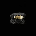 4 Gold Teeth: 10-22K TOPS or BOTTOMS ANY STYLE image 0