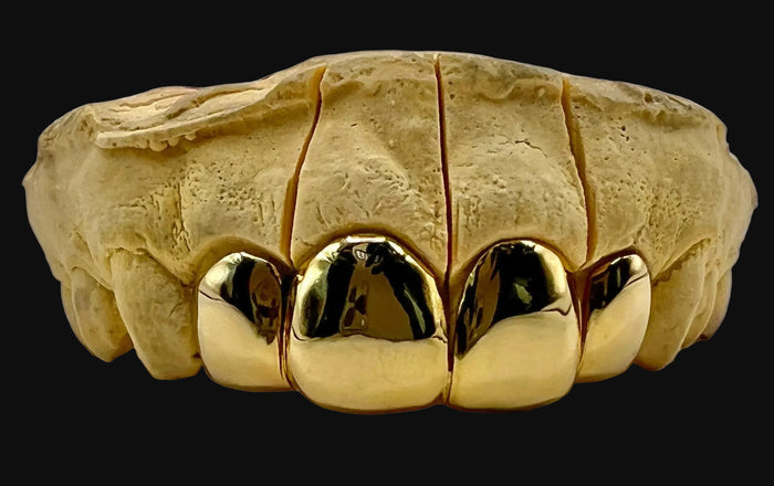4 Gold Teeth: 10k - 22k Tops Grillz image 1