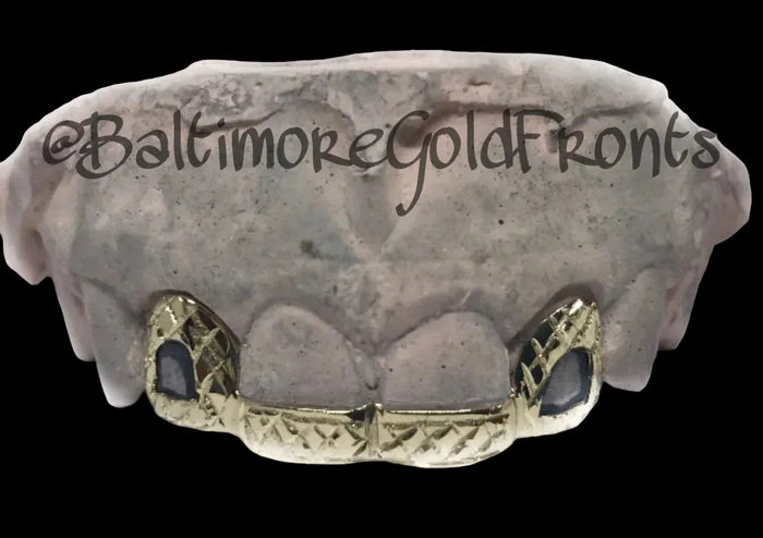 Gold 2 Open Face W/ Front Bridge Diamond Cuts 10k image 0